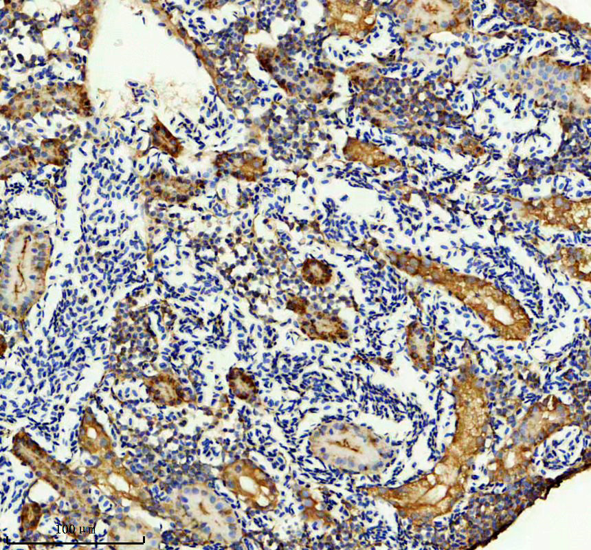 aza0a8m1neq8 lars2 primary antibodies ihc testing 1