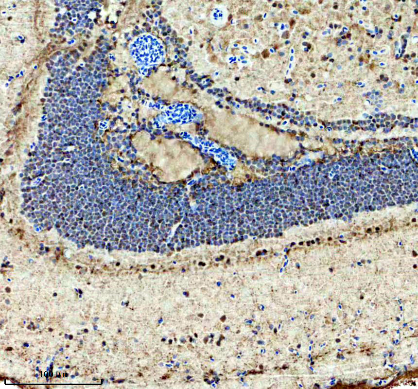 aza0a8m1nh20 hmx1 primary antibodies ihc testing 1