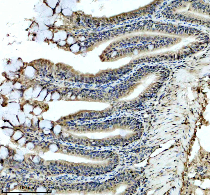 aza0a8m1nh20 hmx1 primary antibodies ihc testing 2
