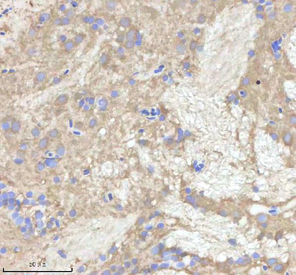 IHC analysis of NPEPPS using anti-NPEPPS antibody (AZA0A8M1NSE3)