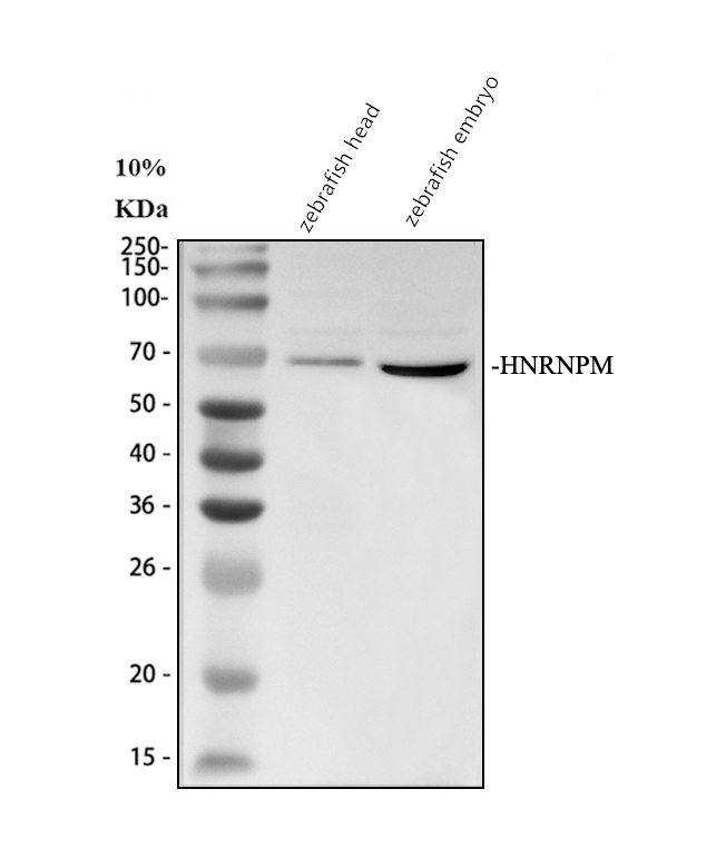 Western blot analysis of HNRNPM using anti-HNRNPM antibody (AZA0A8M1NZJ3)