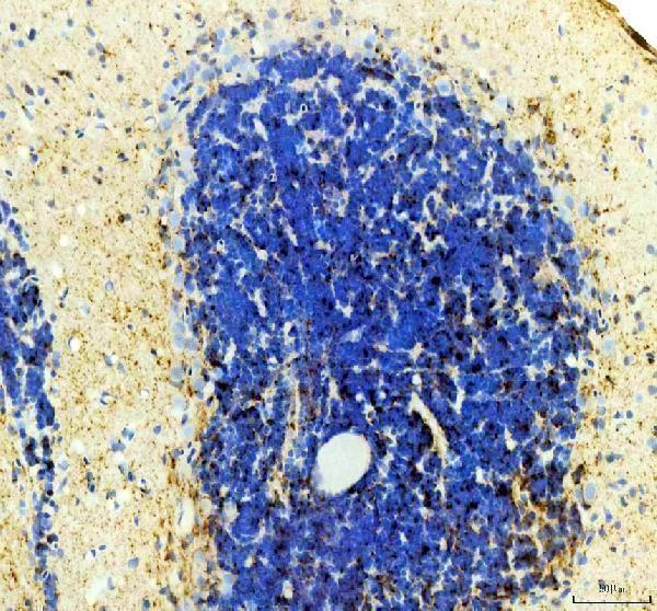 aza0a8m1p485 dio3a primary antibodies ihc testing 1
