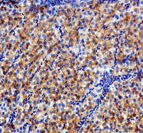 aza0a8m1p485 dio3a primary antibodies ihc testing 2