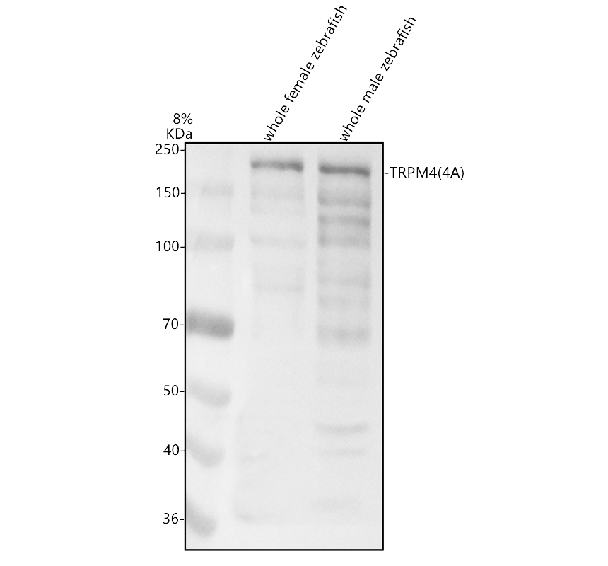 aza0a8m1p6e5 trpm4 4a primary antibodies wb testing 1