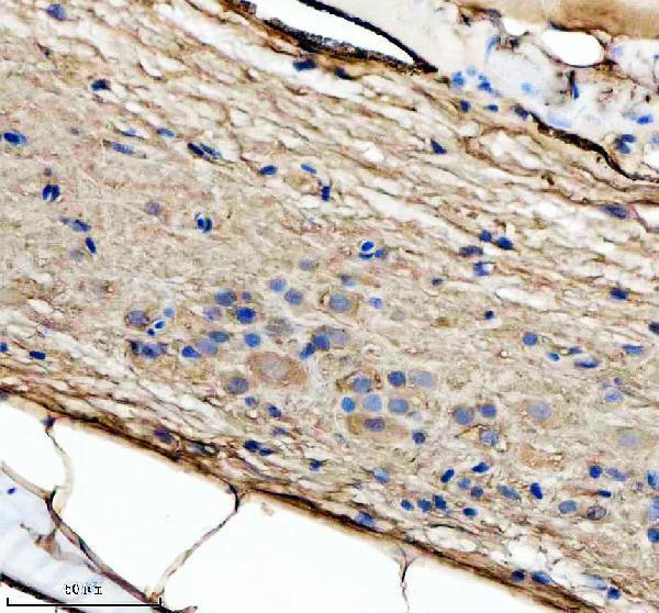 aza0a8m1p735 bdnf primary antibodies ihc testing 1