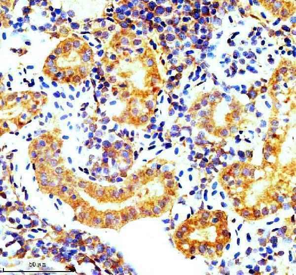 aza0a8m1p9f8 vegfab primary antibodies ihc testing 1