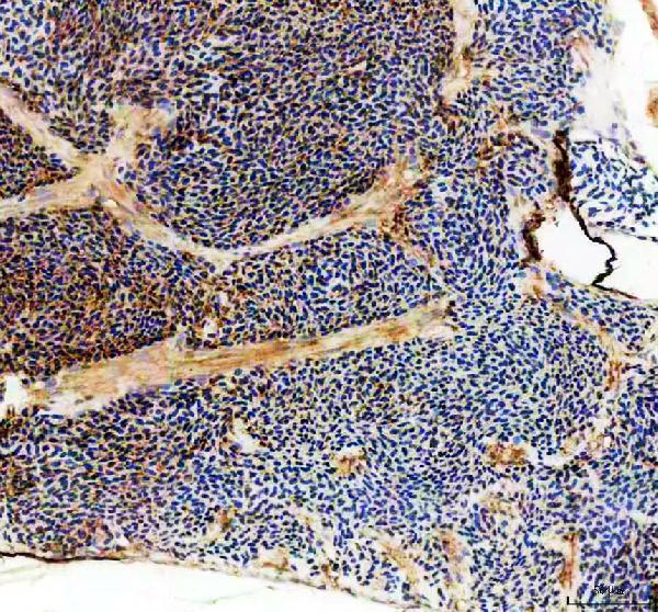 aza0a8m1p9f8 vegfab primary antibodies ihc testing 2