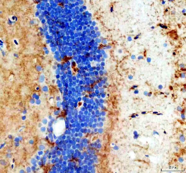 aza0a8m1p9f8 vegfab primary antibodies ihc testing 3