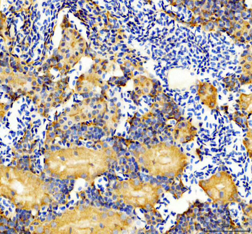 aza0a8m1pac4 il6r primary antibodies ihc testing 1