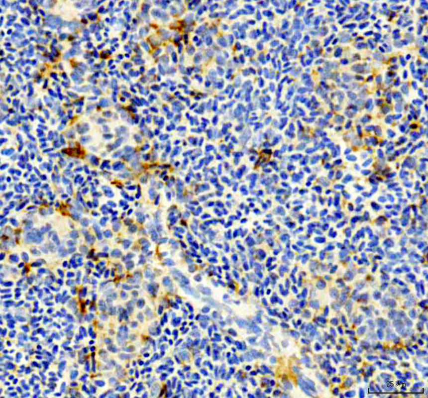 aza0a8m1pac4 il6r primary antibodies ihc testing 2