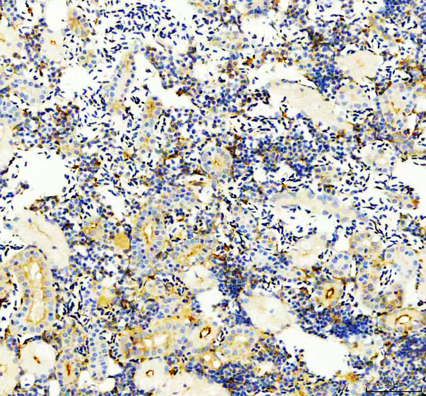 IHC analysis of NT5E using anti-NT5E antibody (AZA0A8M1PBZ9)