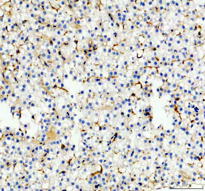 IHC analysis of NT5E using anti-NT5E antibody (AZA0A8M1PBZ9)