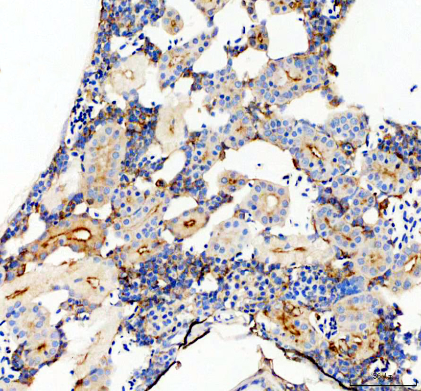 aza0a8m1pbz9 nt5e primary antibodies ihc testing 4