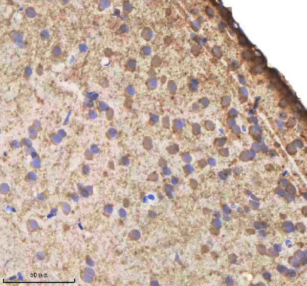  IHC analysis of IL-1 beta/IL1B using anti-IL-1 beta/IL1B antibody (AZA0A8M1PI54)