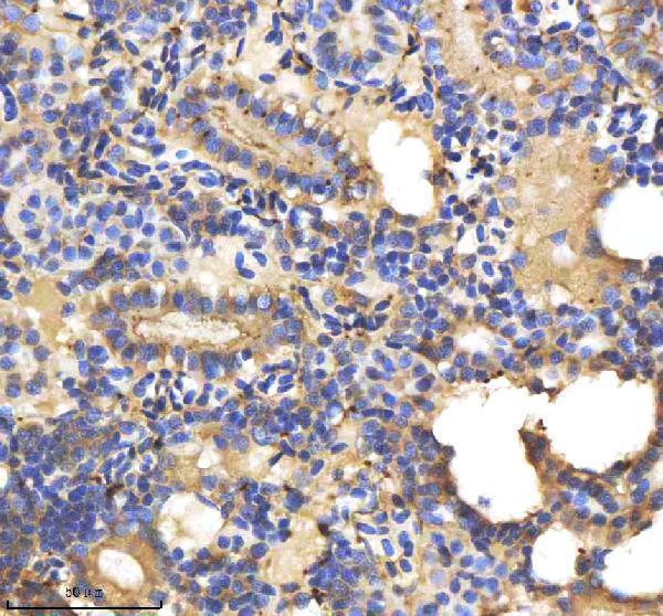  IHC analysis of IL-1 beta/IL1B using anti-IL-1 beta/IL1B antibody (AZA0A8M1PI54)