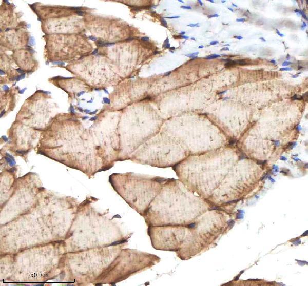 aza0a8m1pi54 il 1 beta il1b primary antibodies ihc testing 5