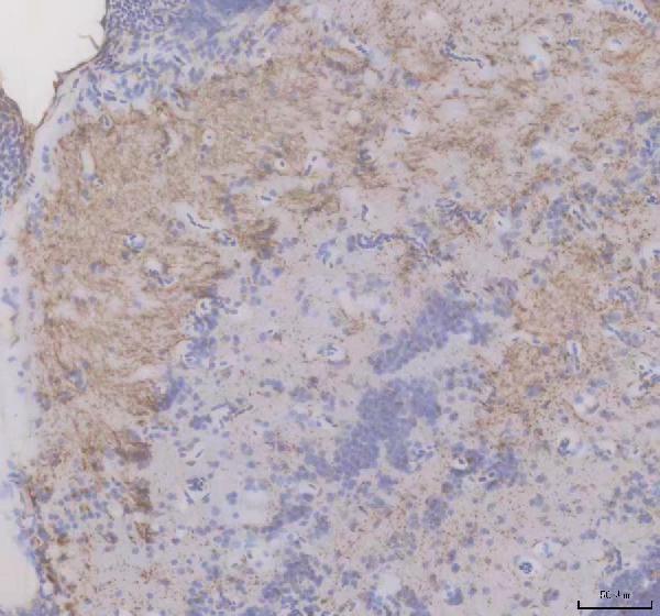 aza0a8m1rf02 fzd9a primary antibodies ihc testing 1