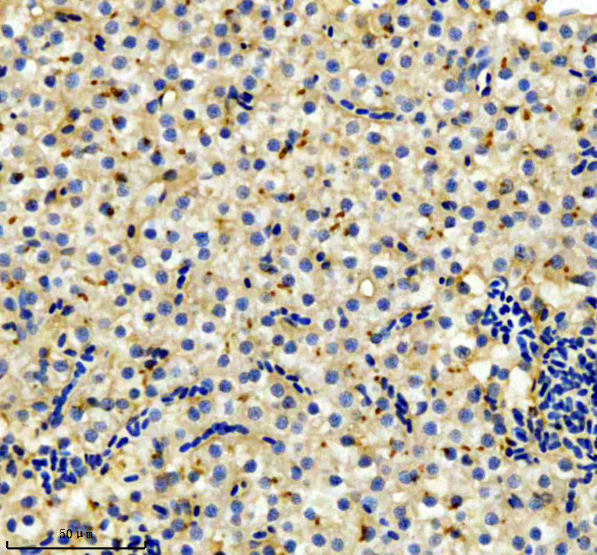 aza0a8m1rnn7 abcb11b primary antibodies ihc testing 1