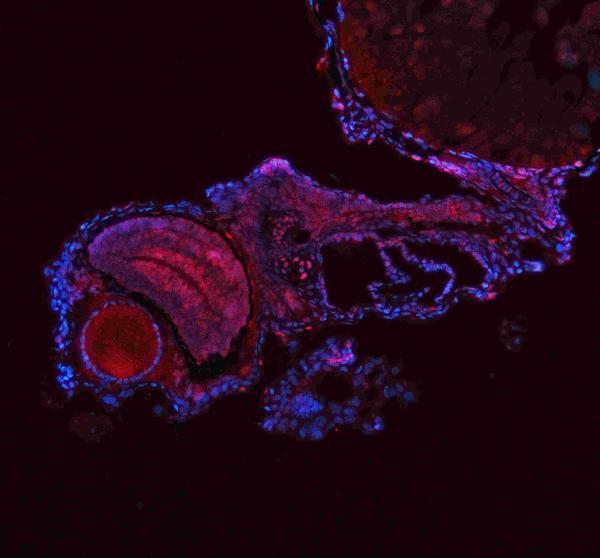 aza0a8m2b2e1 ash2l primary antibodies if testing 2