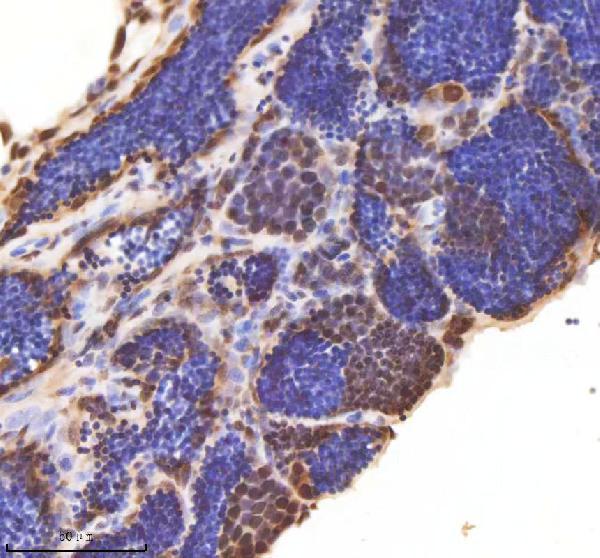 aza0a8m2b2e1 ash2l primary antibodies ihc testing 1