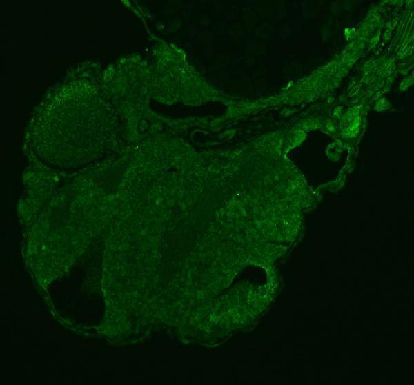 IF analysis of STAT3 using anti-STAT3 antibody (AZA0A8M2BAX1)
