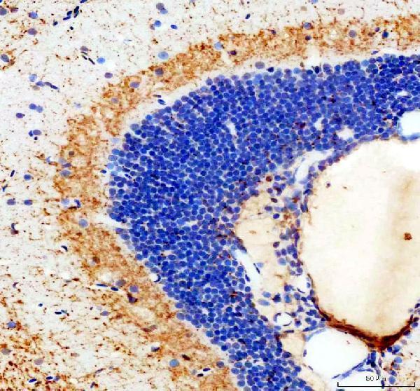 IHC analysis of STAT3 using anti-STAT3 antibody (AZA0A8M2BAX1)