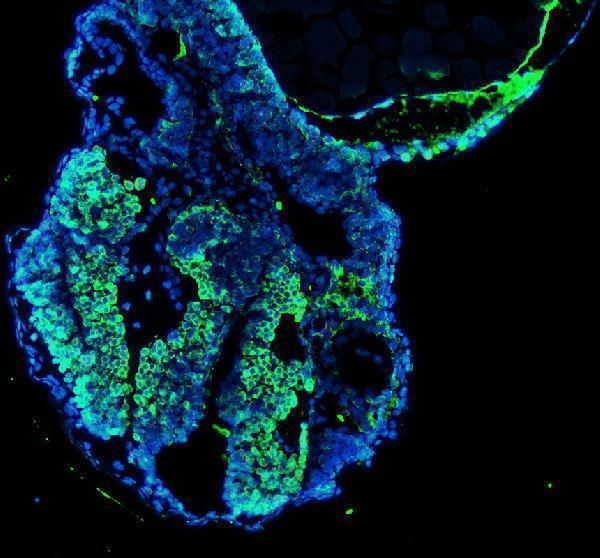aza0a8m2bck7 nova1 primary antibodies if testing 1