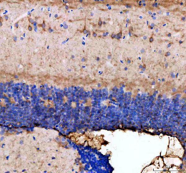 aza0a8m2bg30 dnm1a b primary antibodies ihc testing 1
