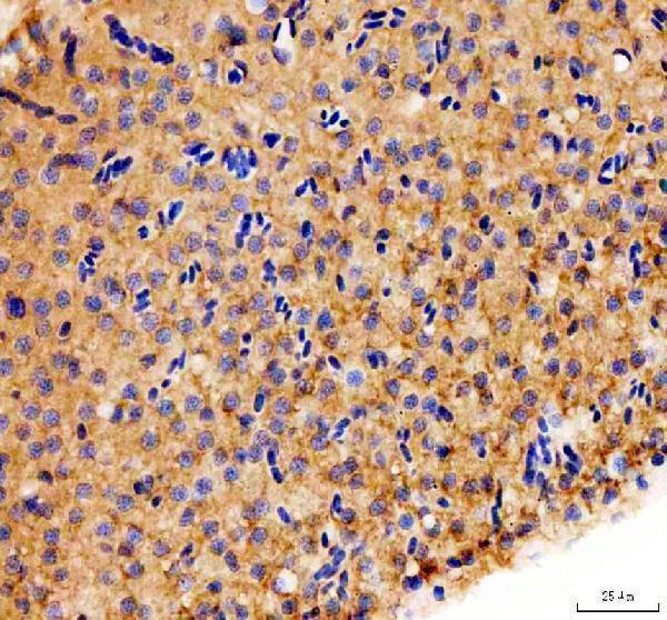 aza0a8m2bg30 dnm1a b primary antibodies ihc testing 2