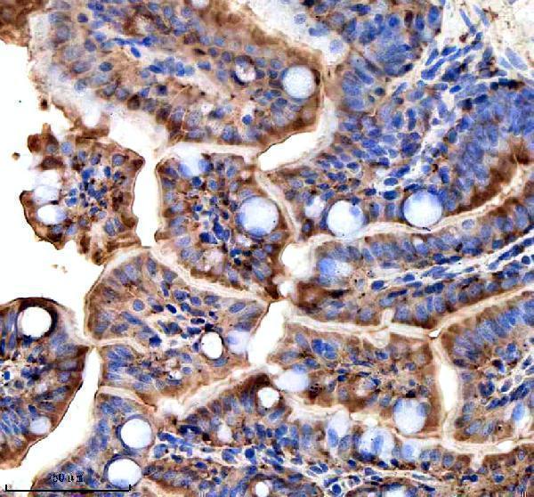 aza0a8m3ajw5 ttc7b primary antibodies ihc testing 1