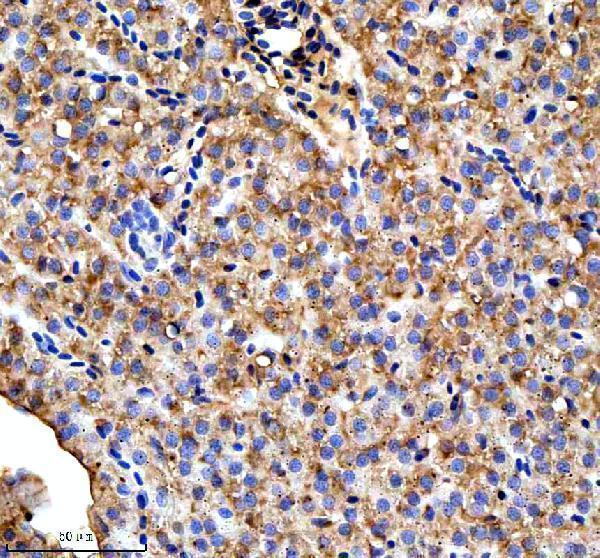 aza0a8m3ajw5 ttc7b primary antibodies ihc testing 2