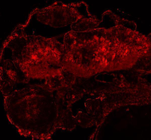 aza0a8m3aqb4 dhx9 primary antibodies if testing 5