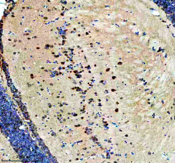  IHC analysis of DHX9 using anti-DHX9 antibody (AZA0A8M3AQB4)