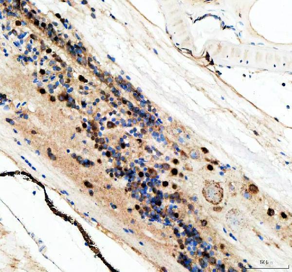  IHC analysis of DHX9 using anti-DHX9 antibody (AZA0A8M3AQB4)