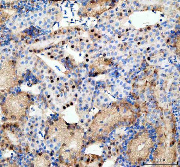  IHC analysis of DHX9 using anti-DHX9 antibody (AZA0A8M3AQB4)