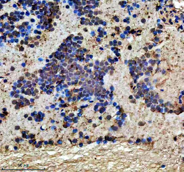 IHC analysis of DMPK using anti-DMPK antibody (AZA0A8M3B300)