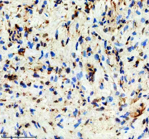 IHC analysis of DMPK using anti-DMPK antibody (AZA0A8M3B300)