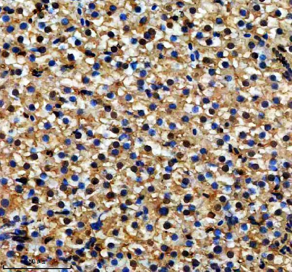 aza0a8m3b300 dmpk primary antibodies ihc testing 3