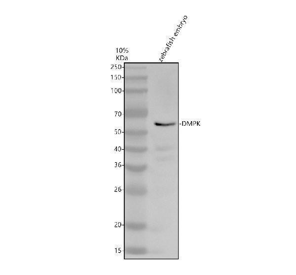 Western blot analysis of DMPK using anti-DMPK antibody (AZA0A8M3B300)