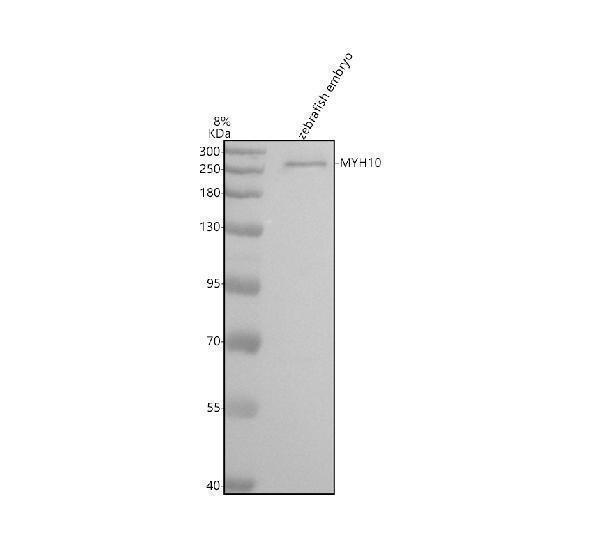  Western blot analysis of MYH10 using anti-MYH10 antibody (AZA0A8M3BA62)