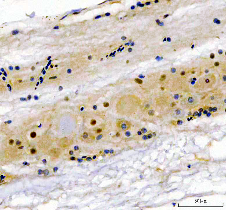 aza0a8m3bd27 nsun5 primary antibodies ihc testing 1