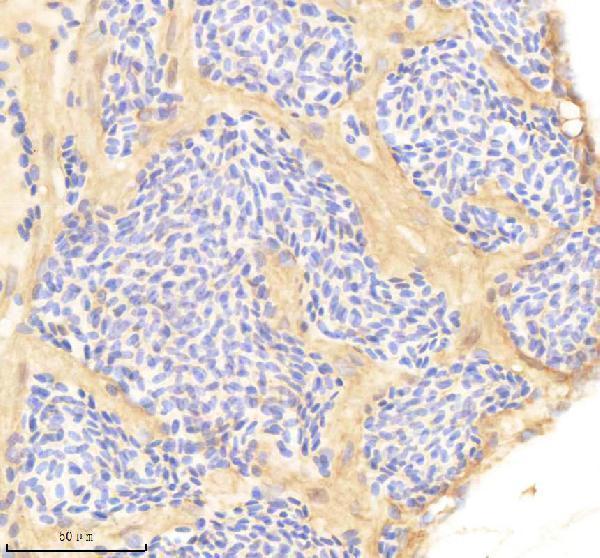 aza0a8m3bef6 ppp3r1a b primary antibodies ihc testing 1
