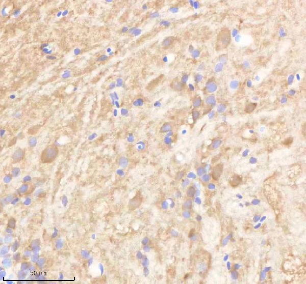 aza0a8m3bef6 ppp3r1a b primary antibodies ihc testing 2