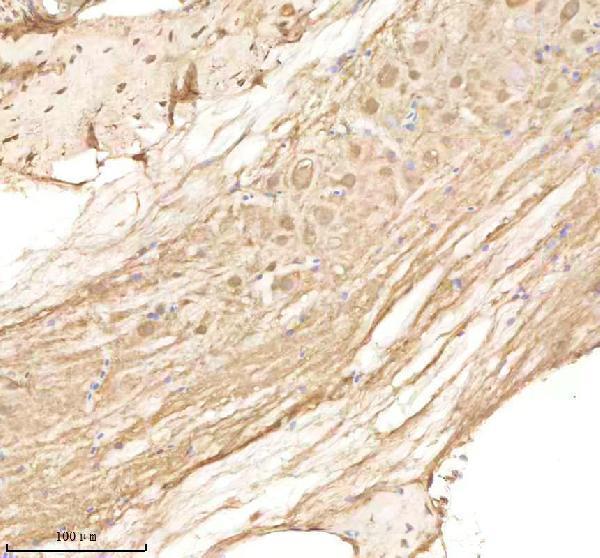 aza0a8m3bef6 ppp3r1a b primary antibodies ihc testing 3