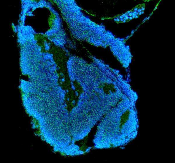 aza0a8m6ytf7 igf1ra primary antibodies if testing 1