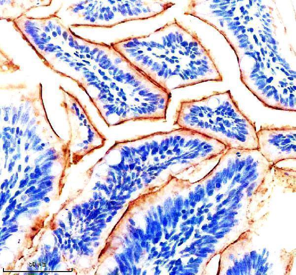 aza0a8m6ytf7 igf1ra primary antibodies ihc testing 1