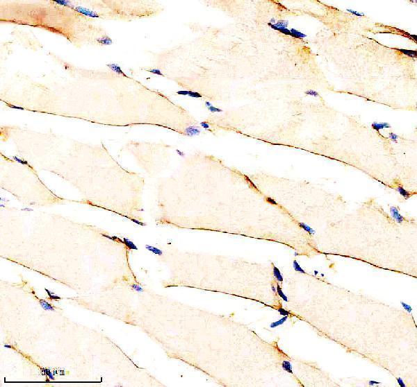 aza0a8m6ytf7 igf1ra primary antibodies ihc testing 2