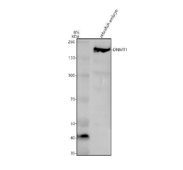 Western blot analysis of DNMT1 using anti-DNMT1 antibody (AZA0A8M6YUX4)
