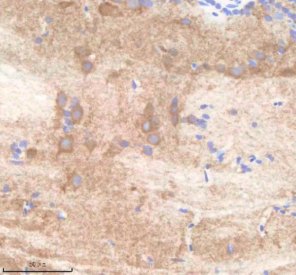 aza0a8m6yy70 pard3aa primary antibodies ihc testing 1