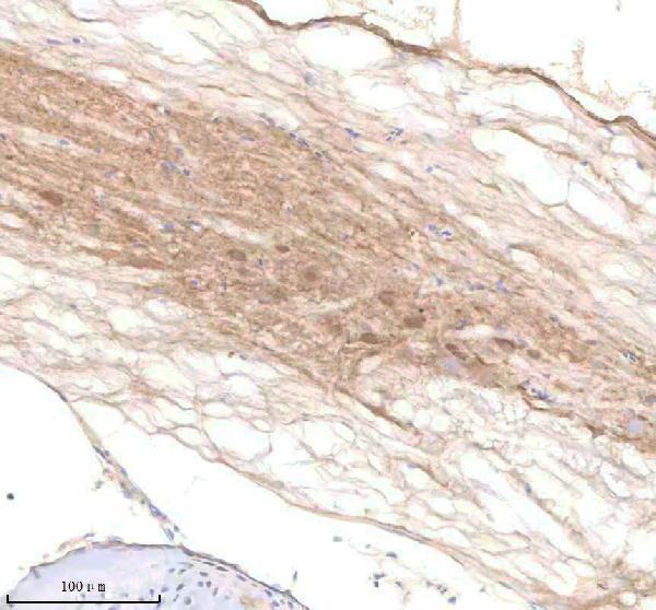 aza0a8m6yy70 pard3aa primary antibodies ihc testing 3